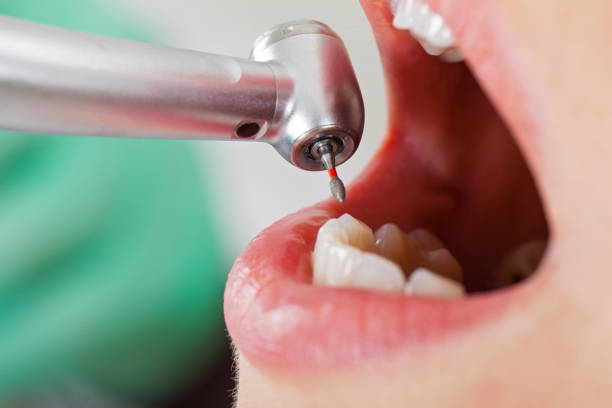 Best Broken or Cracked Tooth Emergency Dentist in Nyssa, OR